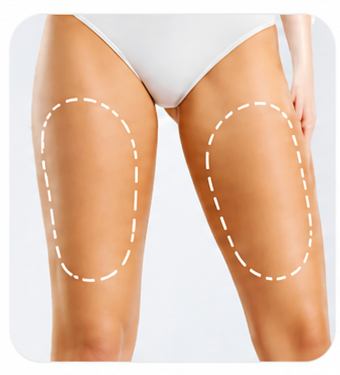 cuisses